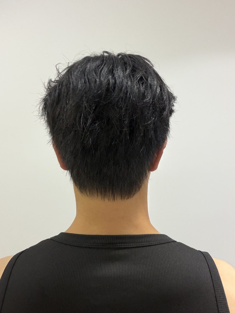 Back view showing the crown and nape