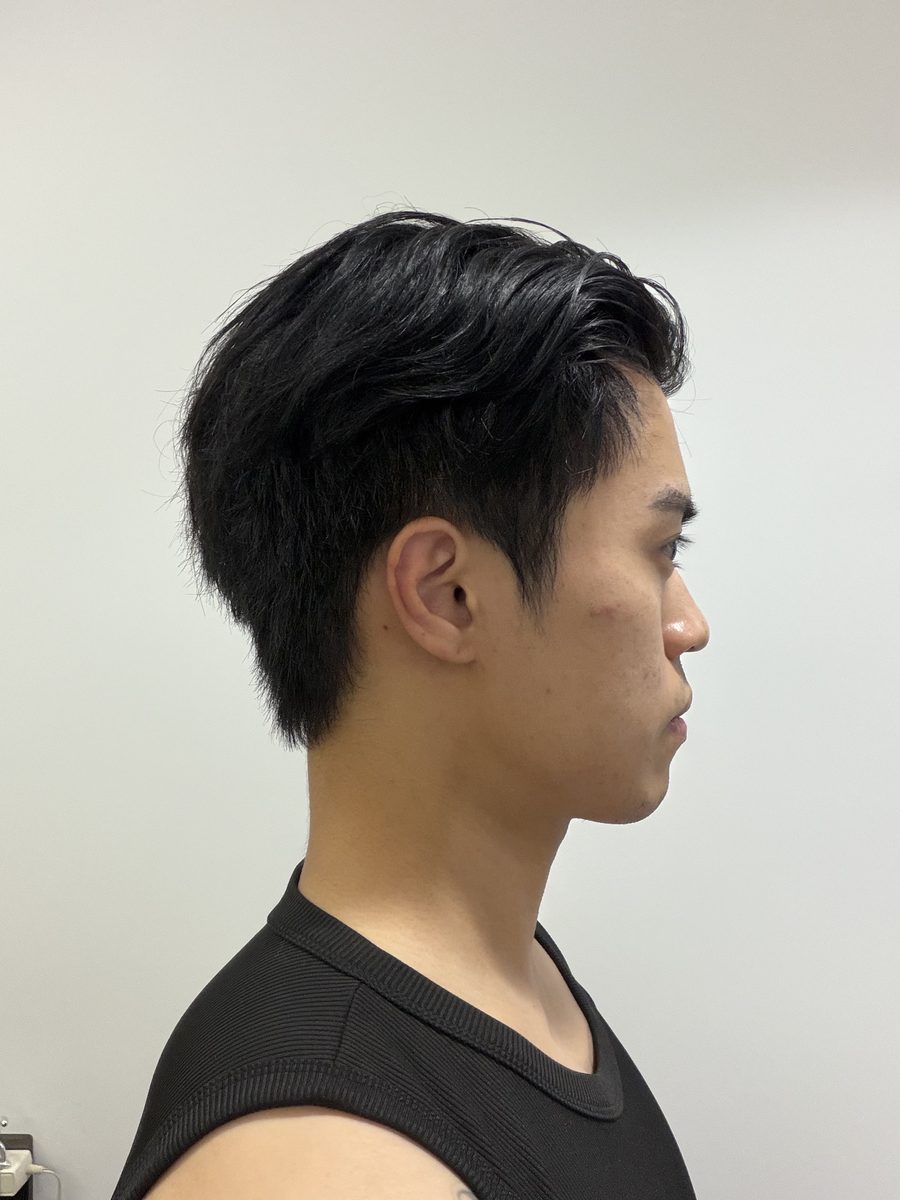 Side view showing how the hair system blends at the temple