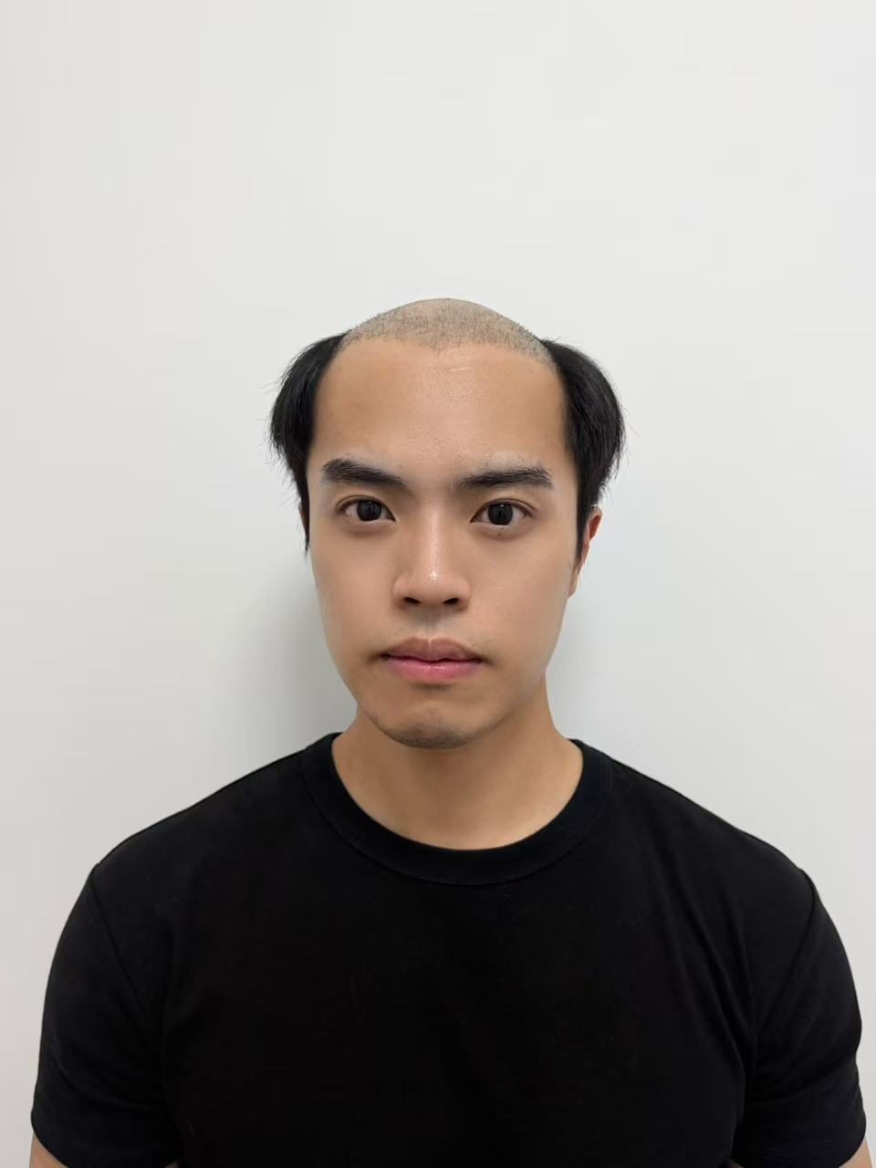 Custom Men's Hair System — Virgin Human Hair - Image 12